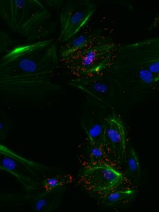 pVEGFR2 on VEGF stimulated HUVEC cells