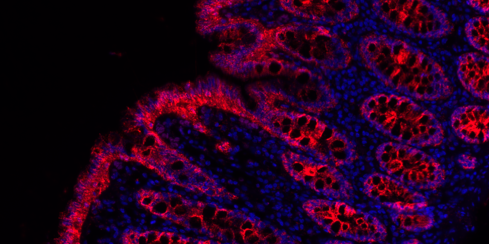 Microscopic image of protein interactions