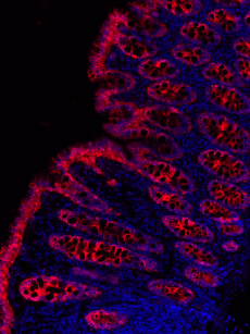 Microscopic image of protein interactions