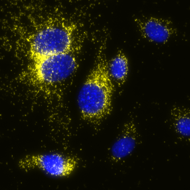 COX1 in MCF7 cells