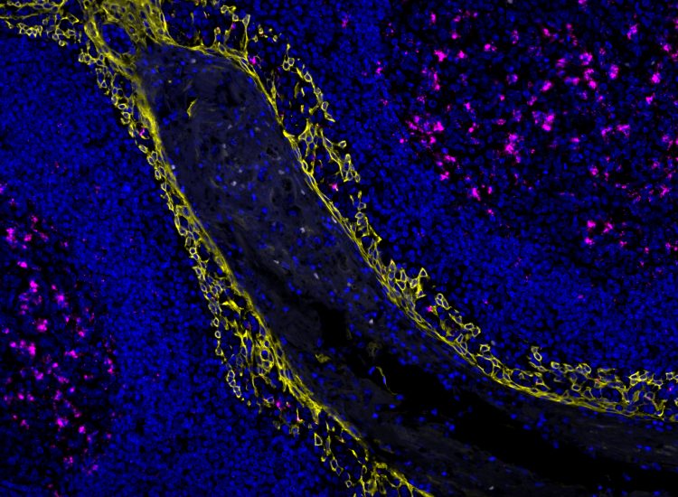 microscopic picture of protein interactions