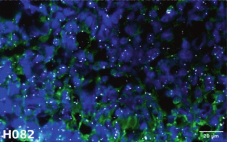 the presence of oligomeric p53